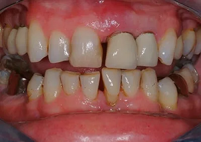 Images Smile Dental Laboratory