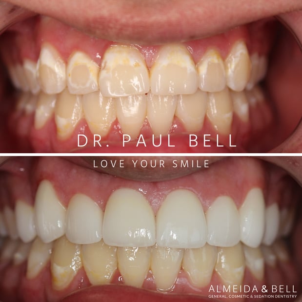 Images Almeida & Bell Dental Lone Tree - General, Cosmetic, and Implant Dentistry