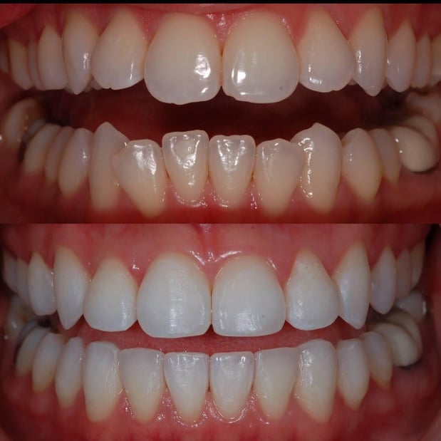 Images Pacific Dental Care