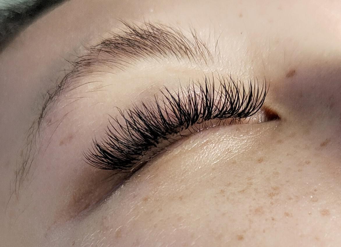 PHIVU, Oberstrasse 175 in St. Gallen