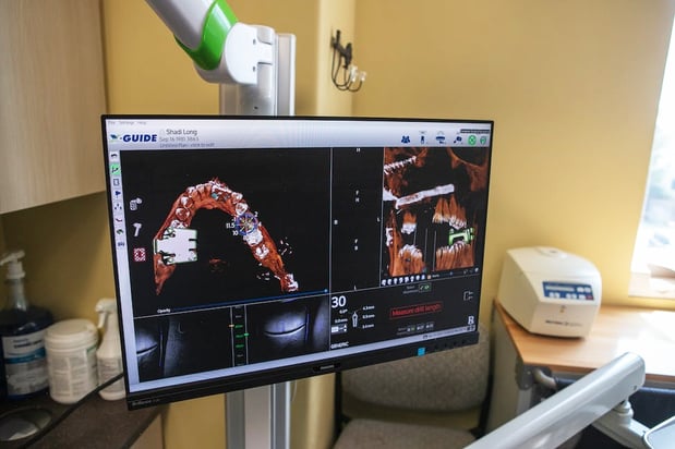 Images Jovan Prosthodontics