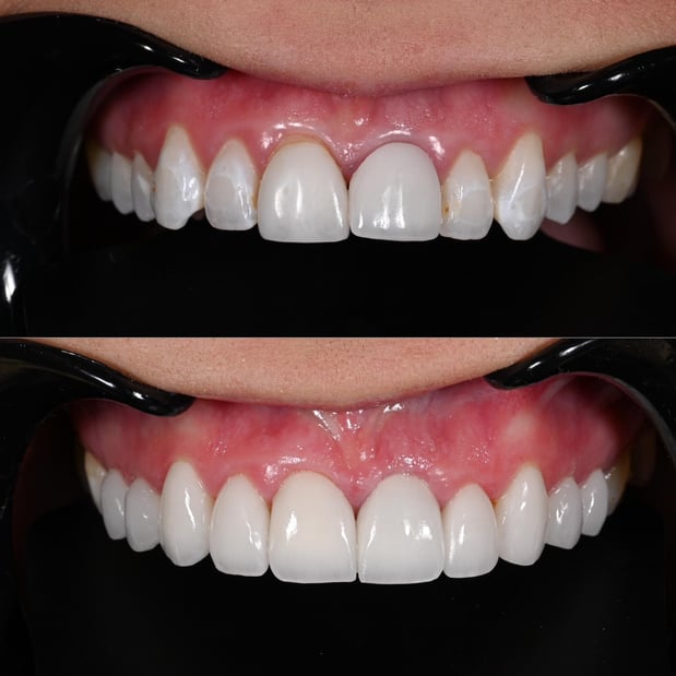 Images Nashville Wisdom Teeth and Implant Solutions