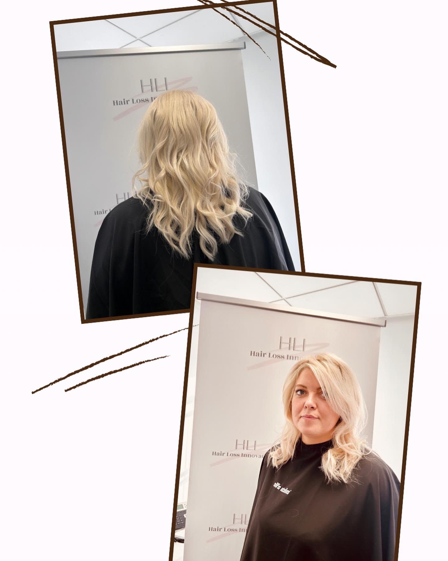 Images HLI - Hair Loss Innovations & Training