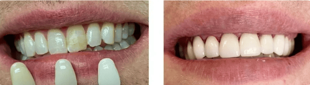 Images Allen Dentistry