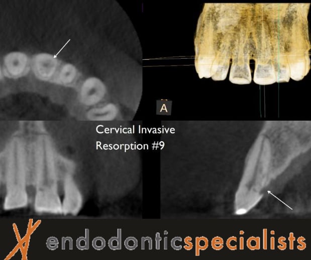 Images Tyler F Baker, DDS MS - Endodontic Specialists