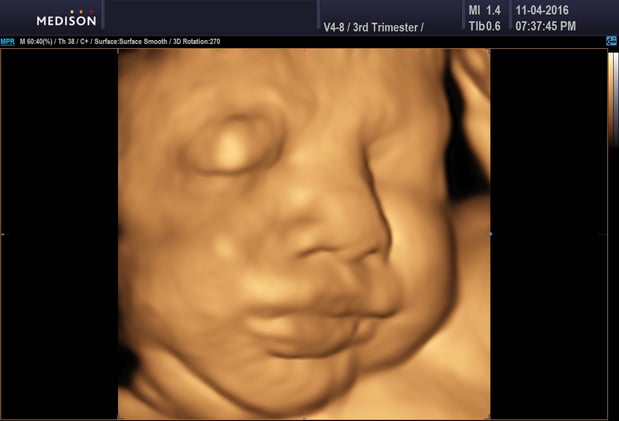 Images Heavenly 3D 4D Ultrasounds