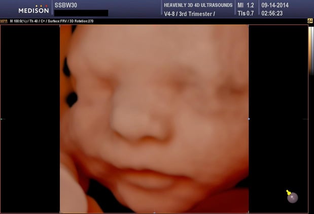 Images Heavenly 3D 4D Ultrasounds-Upland
