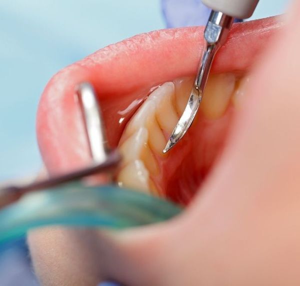 Imagecare Dental Group in Plano, TX (972) 6185000