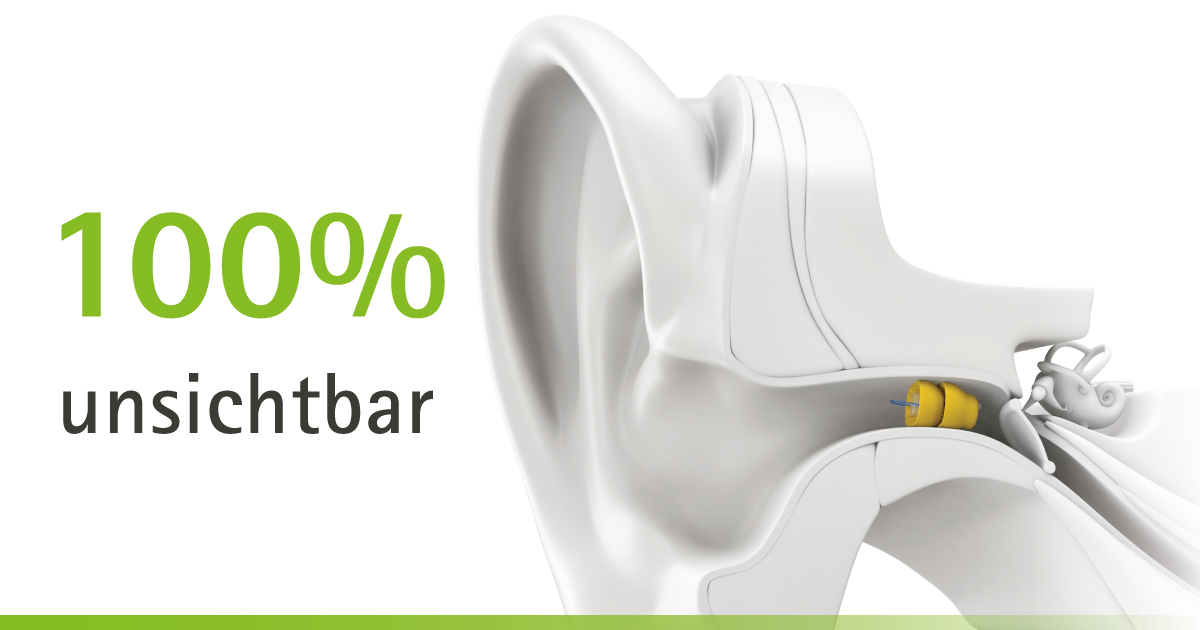 Hörberatung Wettingen Heinz Anner AG, Landstrasse 88 in Wettingen