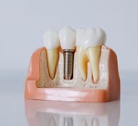 Images Smile Stop Dentures & Implants