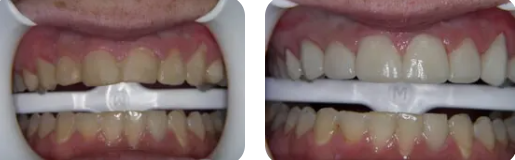 Images Paige Prather Smiles