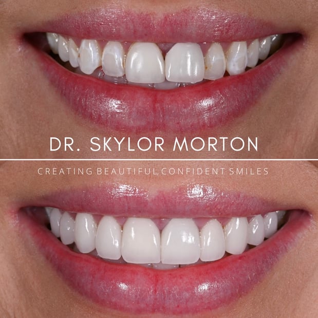 Images Nashville Wisdom Teeth and Implant Solutions