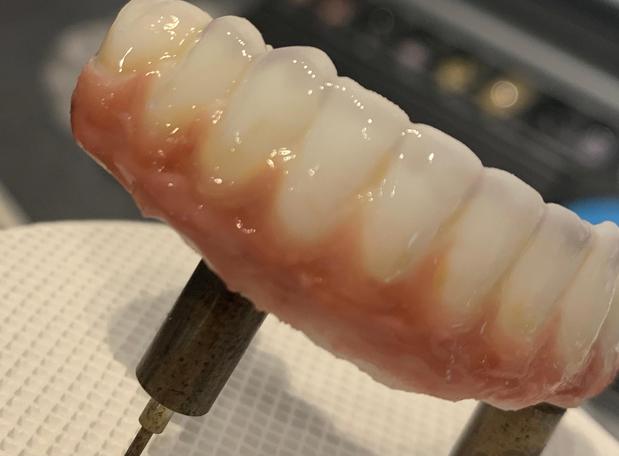 Images South Shreveport Dental