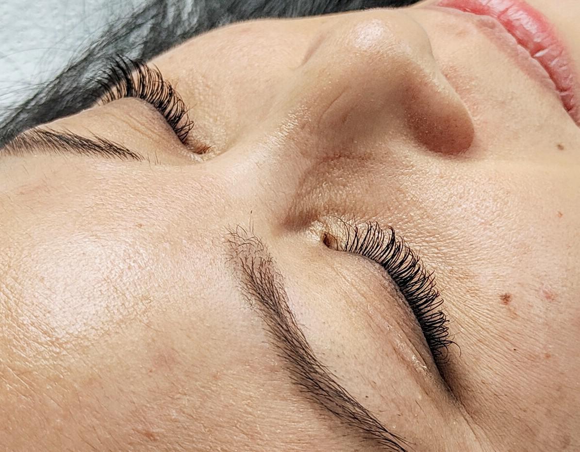 PHIVU, Oberstrasse 175 in St. Gallen