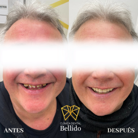 Images Clínica Dental Bellido