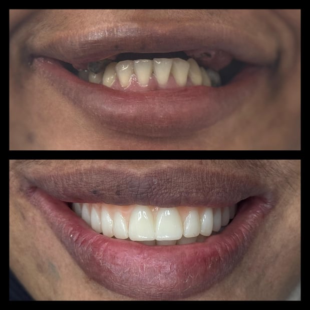 Images smile4me Dental Care - Astoria, Queens