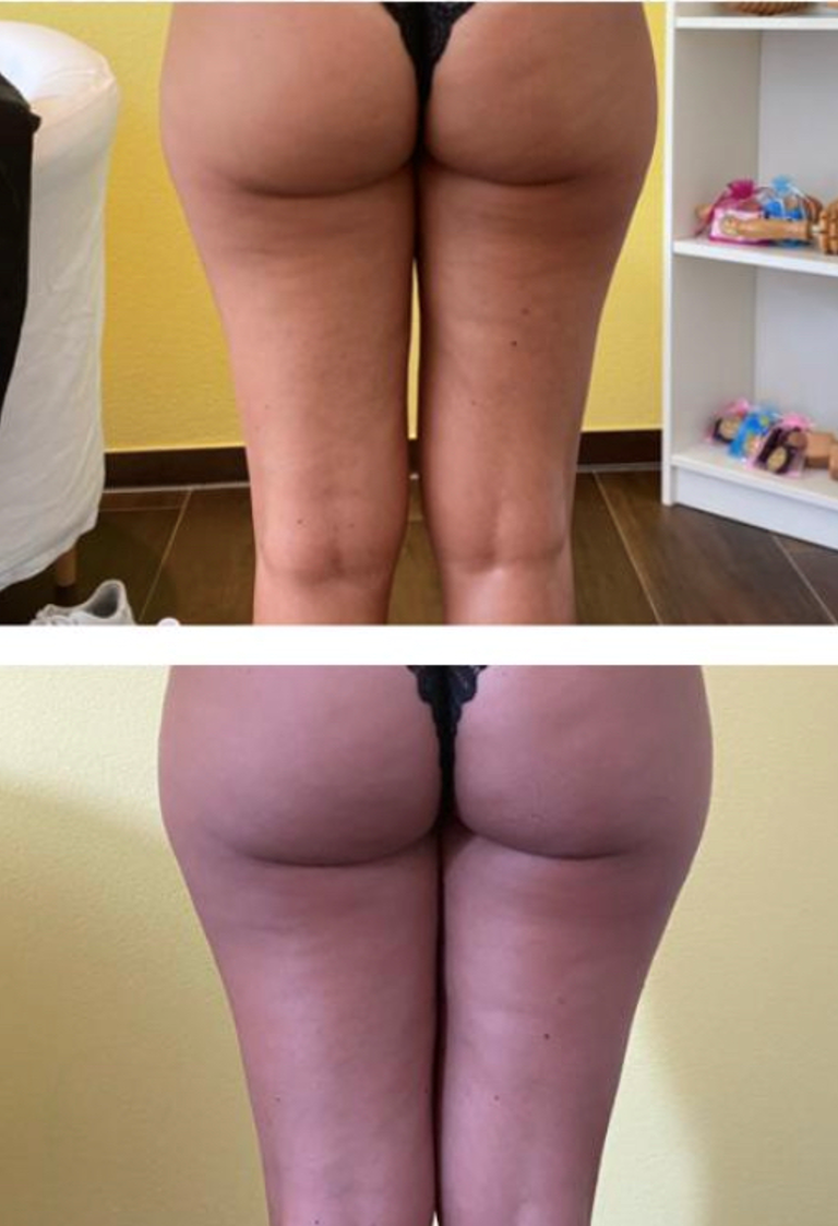 Vacuum Fit 100, Ackerstrasse 16 in Kloten