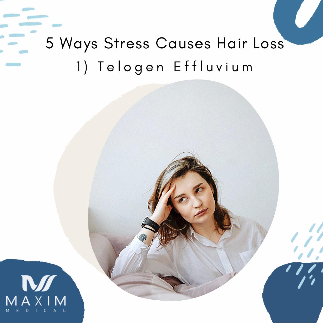 1. Telogen Effluvium
Also known as Temporary Hair Loss, Telogen Effluvium can be a result of high stress. Telogen phase or the resting phase, which is also known as the shredding phase is a stage in the natural hair cycle. Essentially what occurs in this phase normally is that 90% of hair is in the growing phase while the other 10% is in the telogen/resting phase, waiting to fall out. In the case of TE, stress sends a large number of hair into the resting phase. Therefore more hair strands are forced into the resting phase than normal. These dormant hair strands would remain dormant for 2 to 3 months from the beginning of the underlying illness, and then starts to fall off.