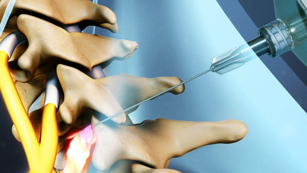 Images Integrated Pain Management: Dr. Tian Xia