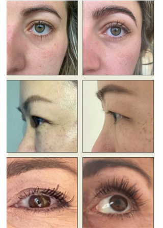 Sérum Volumateur pour cils Lucim+®