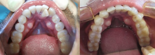 Images Premier Dental of South Orange County