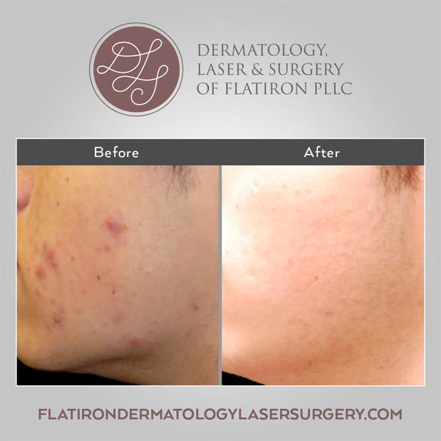 Images Dermatology, Laser & Surgery of Flatiron PLLC