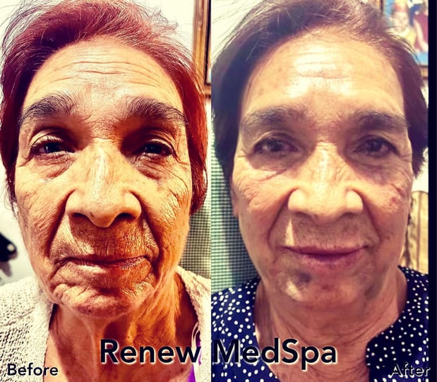 Images Renew Body Contouring & MedSpa
