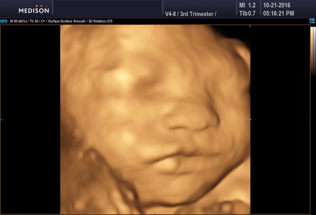 Images Heavenly 3D 4D Ultrasounds