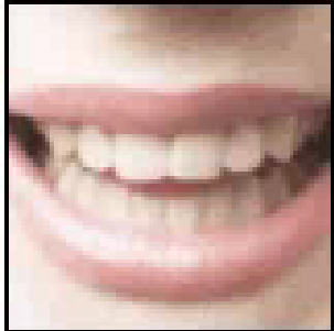 Images E Z Dental