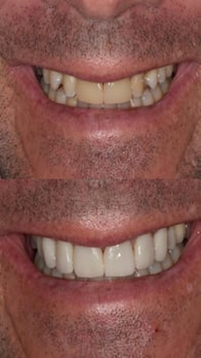 Galindo Prosthodontics