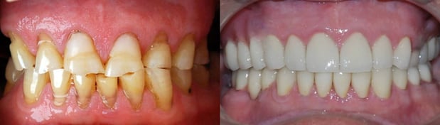 Images Today's Dental Care