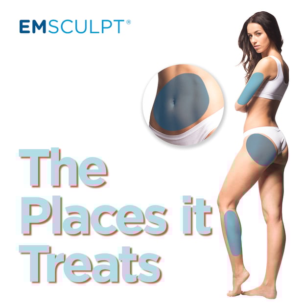 Images Columbus Emsculpt