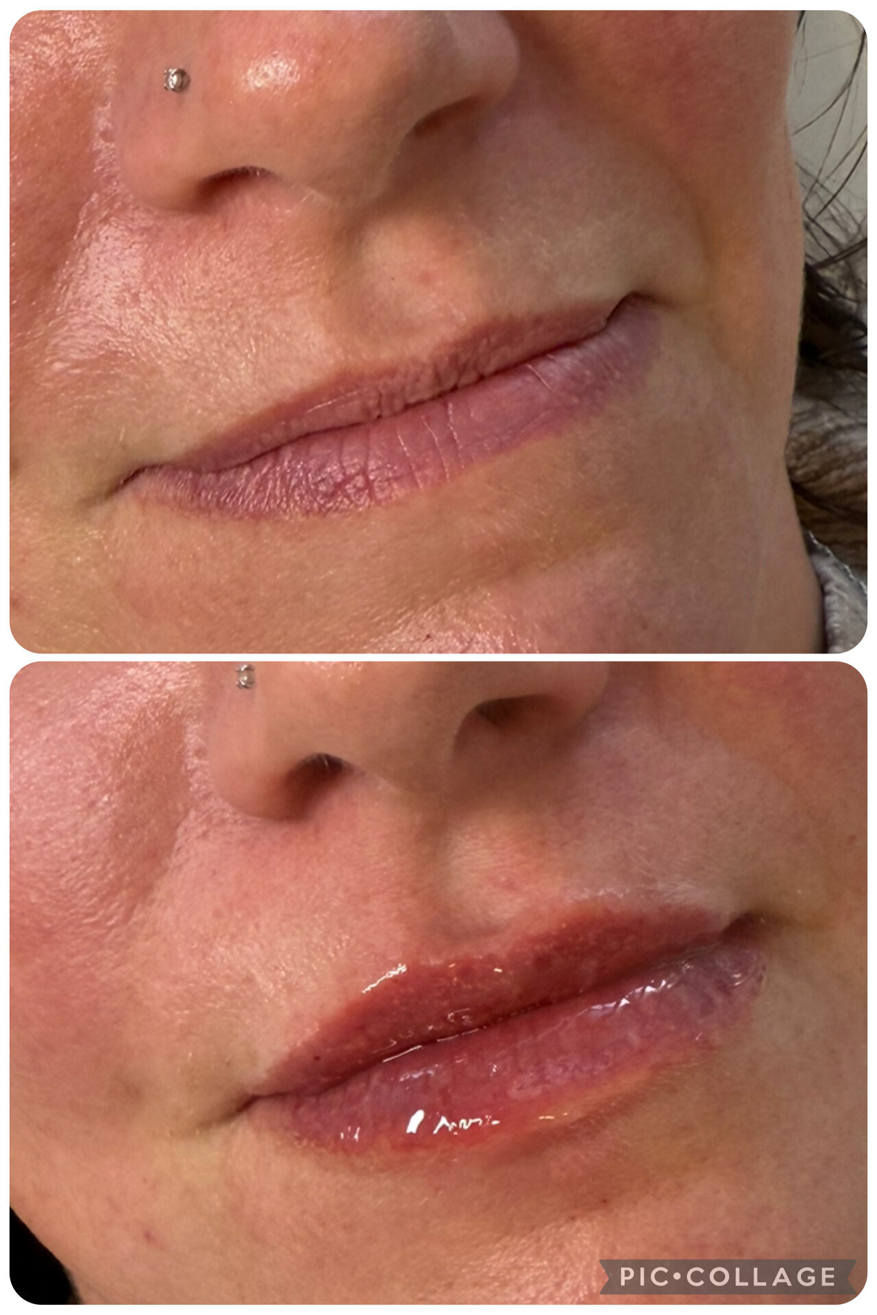 Images Harvey Medical Aesthetics