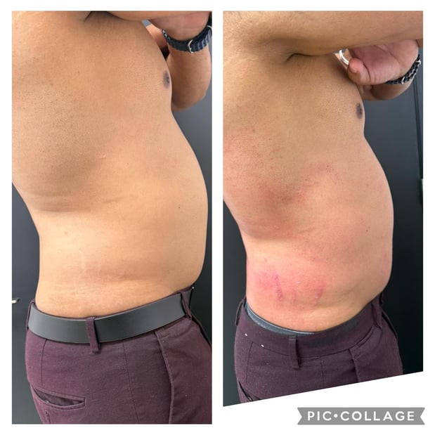 Images Sunkissed Med Spa