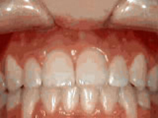 Images Marsh Orthodontics - William F Marsh DDS