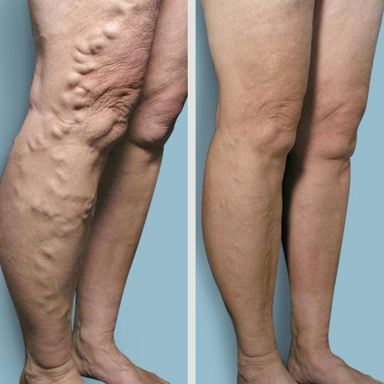 Images Metro Vein Centers | Fairfield