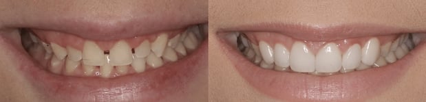 Images Iroquois Dentistry