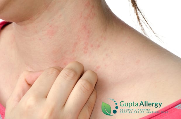 Images Gupta Allergy: Allergy & Asthma Specialists of Lansing, PLLC