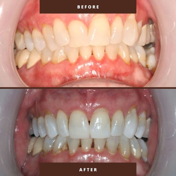 Images Victor R. Siegel, DDS
