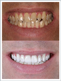 Images Softouch Dental Care: Dr. Michael K. Chung, DDS