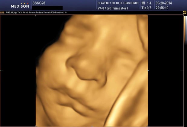 Images Heavenly 3D 4D Ultrasounds-Upland