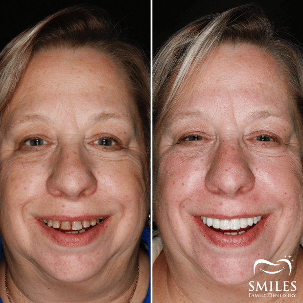 Images Brunswick Smiles Family Dentistry Implant, Oral Surgery, and Cosmetic Dentist