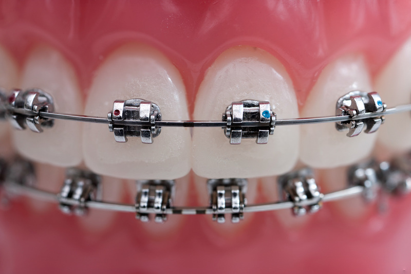 Foto's Henneman van Hees Orthodontisten