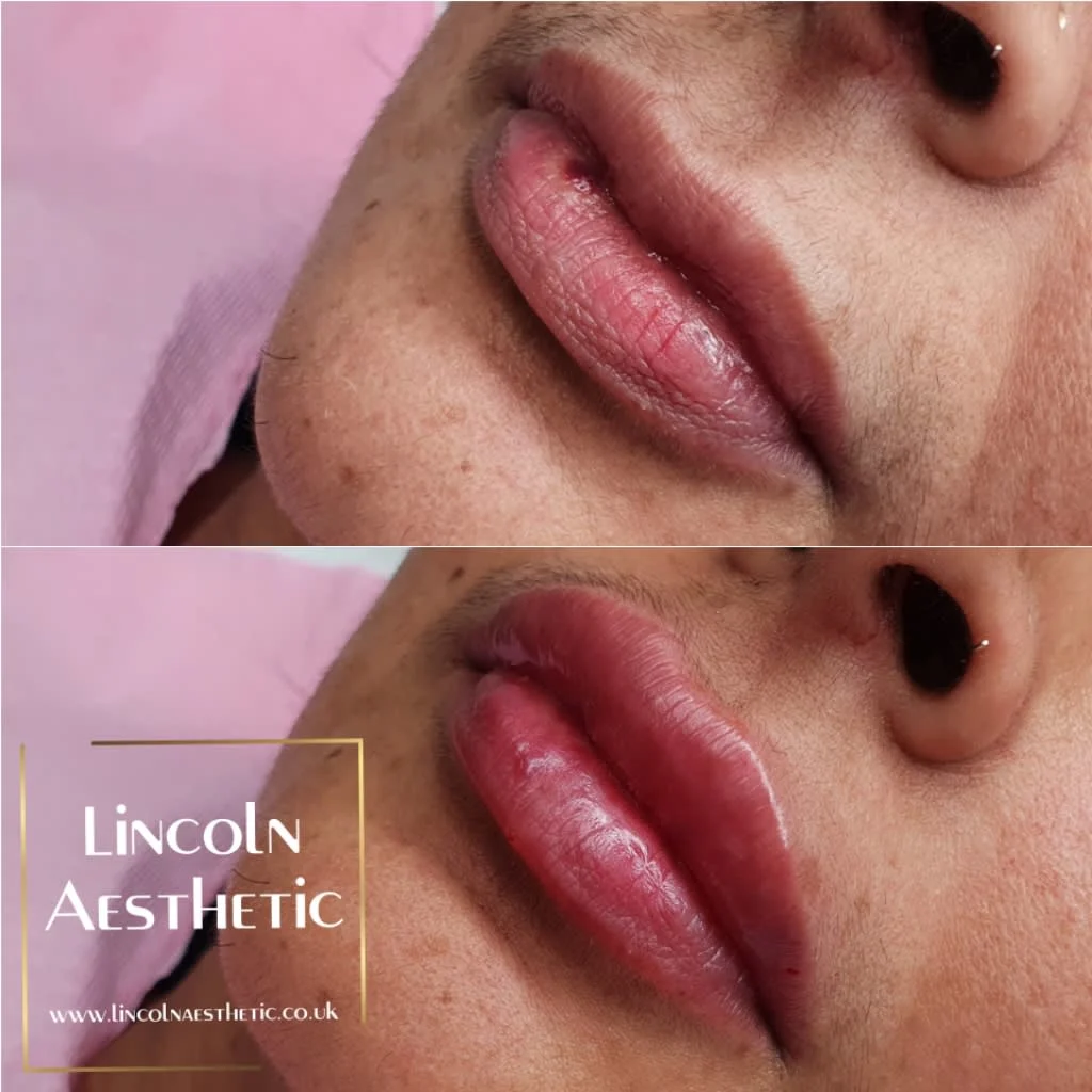 Images Lincoln Aesthetic