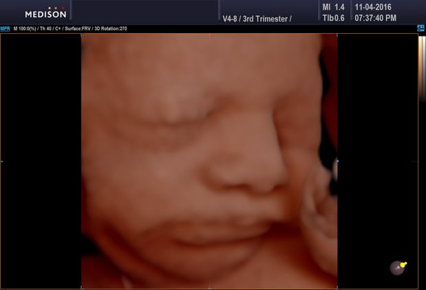 Images Heavenly 3D 4D Ultrasounds