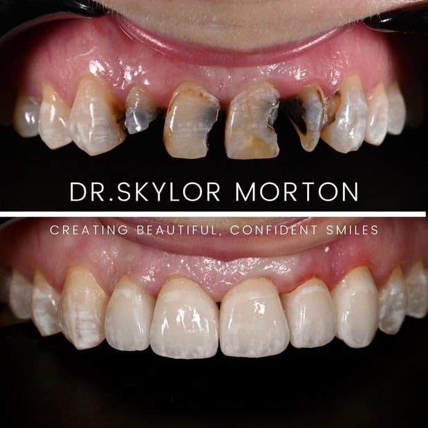 Images Nashville Wisdom Teeth and Implant Solutions