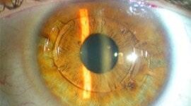 Images Dr. Jóel Ransom Becker