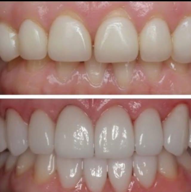 Images Smiles By Eddie: Dr. Edmond Ahdoot DDS