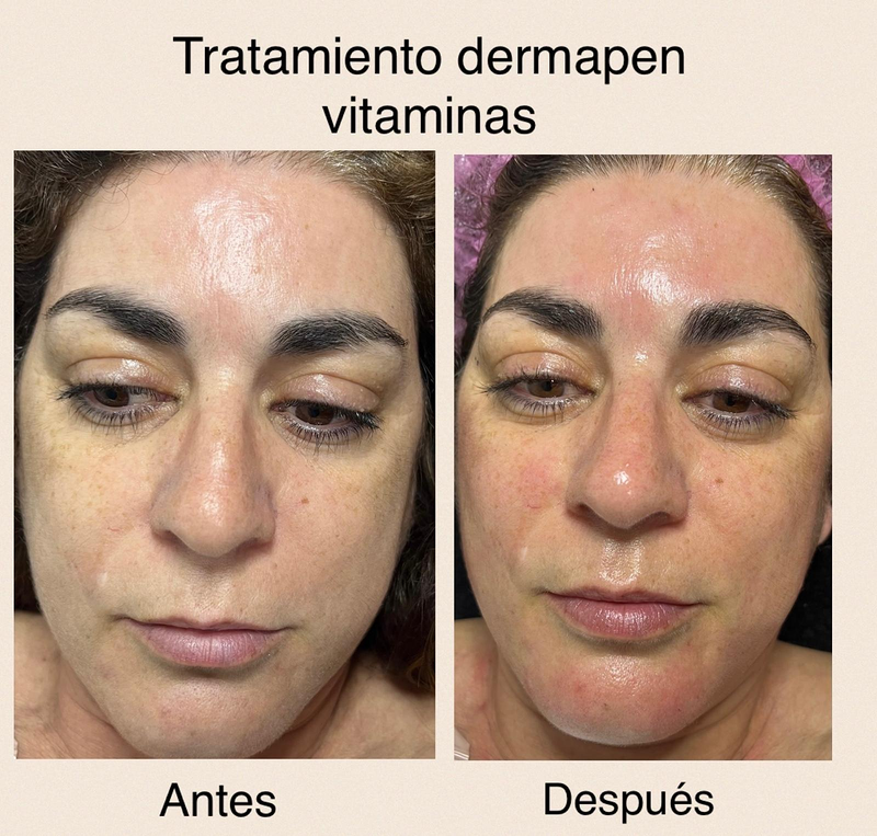 Images Centro De Estética Avanzada Y Láser Verónica Vico