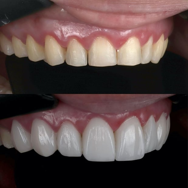 Images Gables iSmile